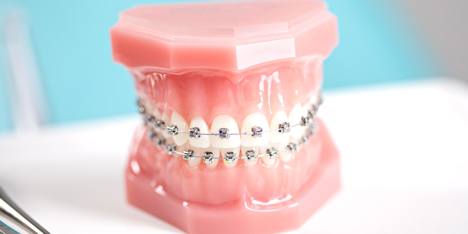 当院の矯正歯科の特徴について